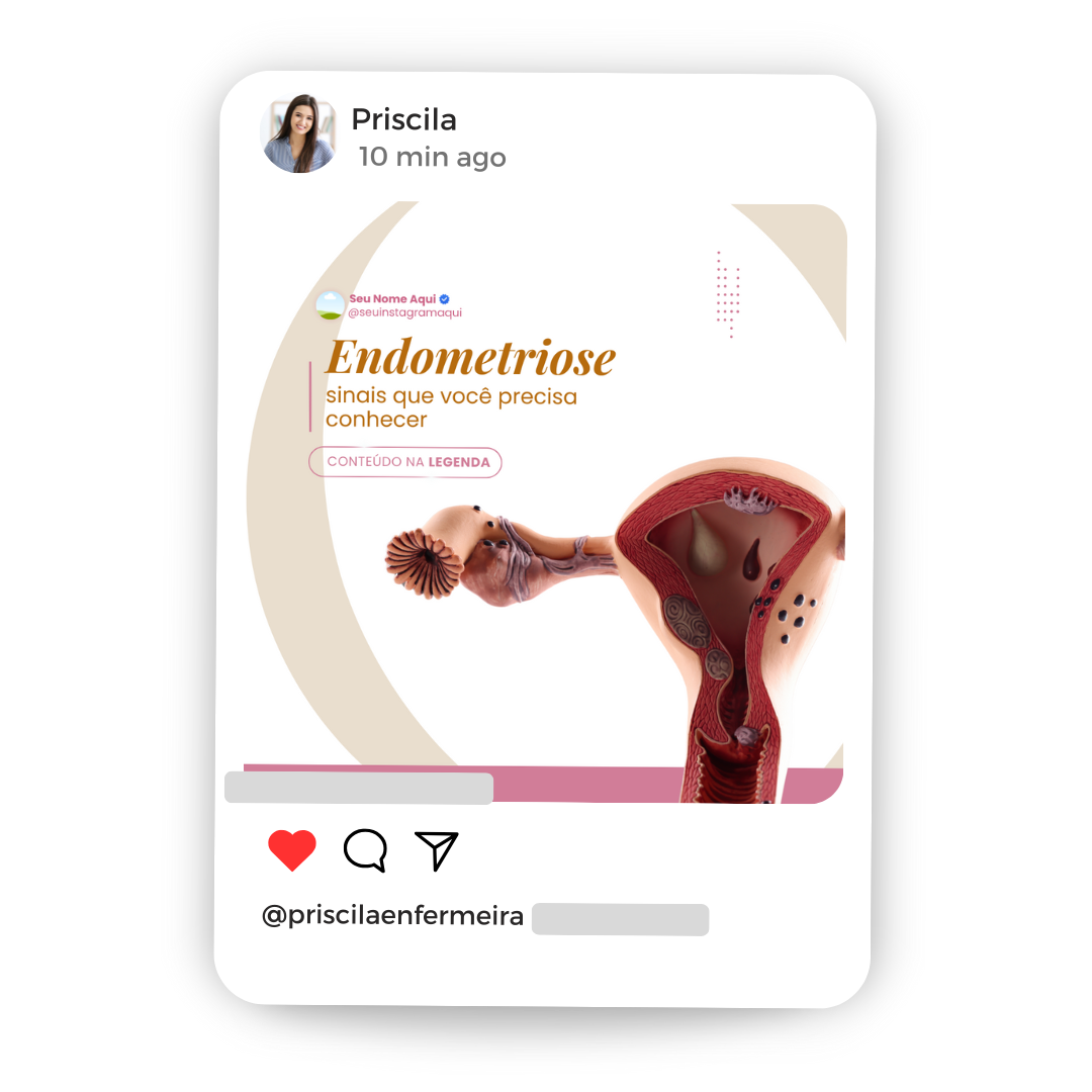 Criativos CHECKOUT (36)