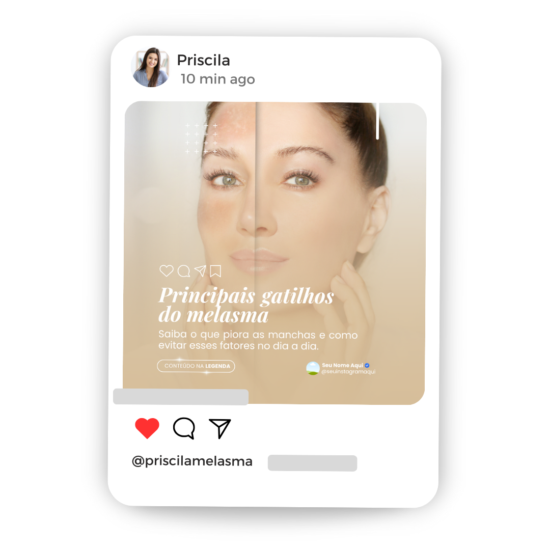 Criativos CHECKOUT (44)