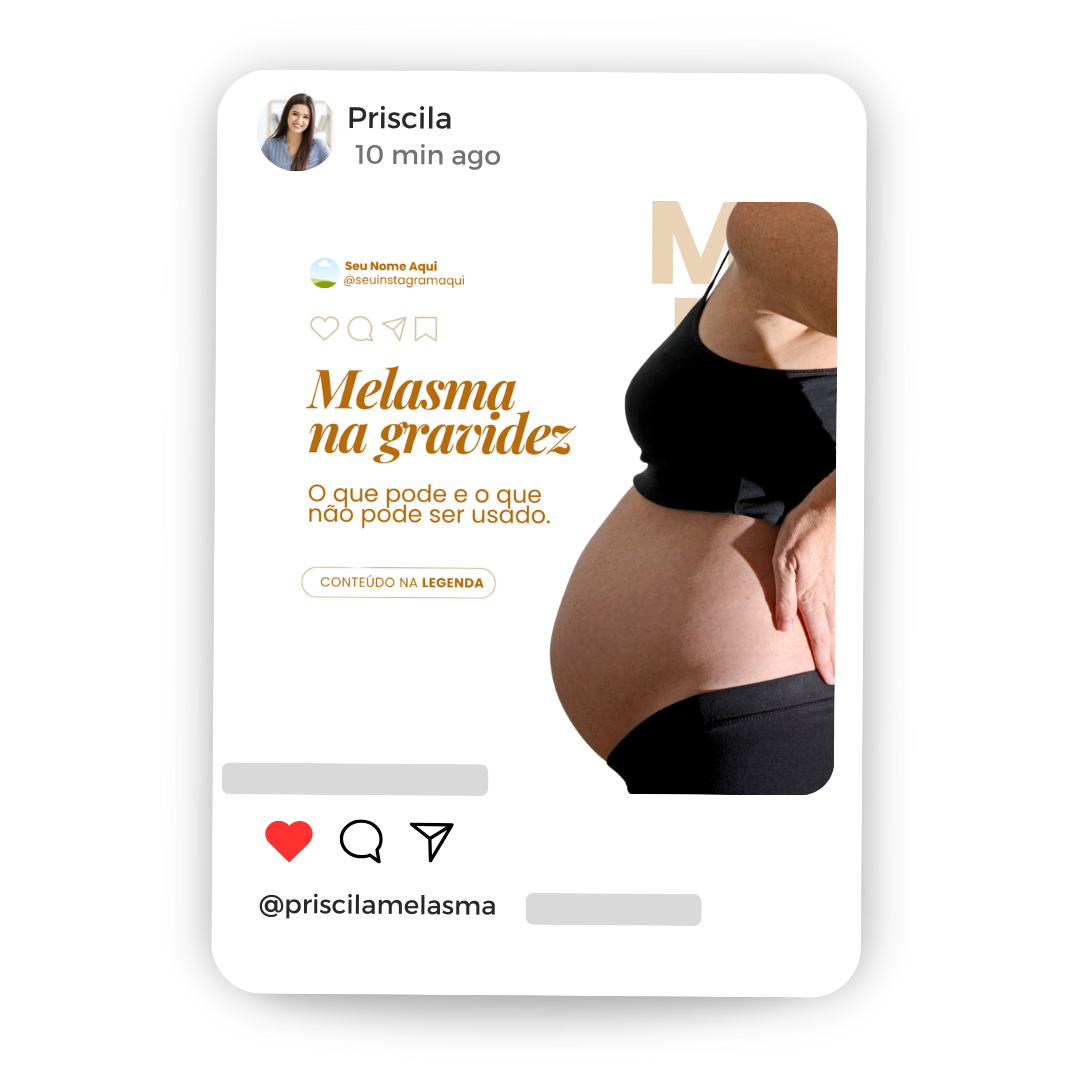 Criativos CHECKOUT (45)